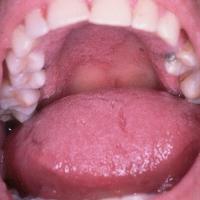 
	Same patient as previous image