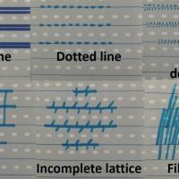 Variants of the furrow pattern (all benign)Copied…