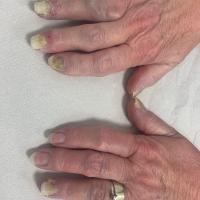 Same patient
Copied with kind permission from…