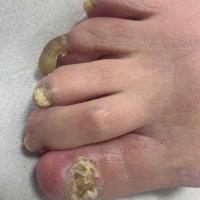 Same patient
Copied with kind permission from…