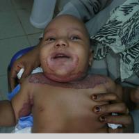 
	Same patient as previous