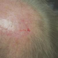 Same patient as previous figure - scale removedNo…