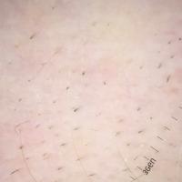 Exclamation mark hairs
Copied with kind…