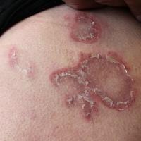 
	Same patient as previous image