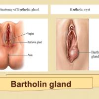 
	Bartholin's gland and cyst