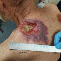 Same patient as previous figure