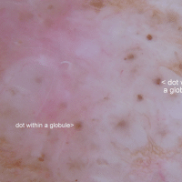 Dot within a clod - magnified&nbsp;