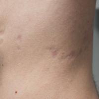 Same patient as previous image