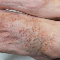 
	Same patient as previous image