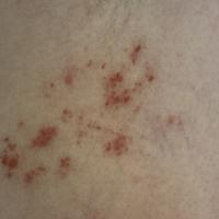 
	Same patient as previous image