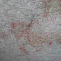 
	As previous image