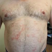 
	Same patient as previous image 