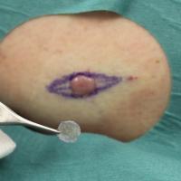 
	Same patient as previous image - scale removed