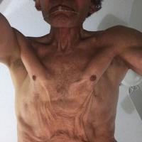 
	As previous image

	The clinical features…