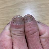 Same patient as&nbsp;previous image
