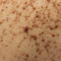 
	As previous image close-up