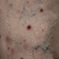 
	Same patient as previous image