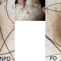 Central white structures - best seen in polarised…