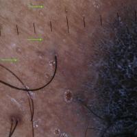 Close-up of the previous imageThe green arrows…