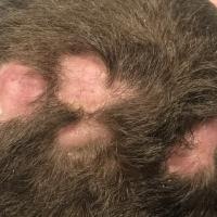 Dissecting cellulitis&nbsp;
Multiple tender…