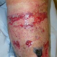 
	Same patient as previous figure&nbsp;