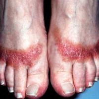 
	CAD: thiuram in rubber footwear