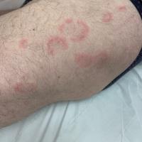 Same patient as previous image