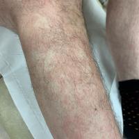 Same patient as previous image