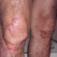 
	The same patient as previous image

	The…