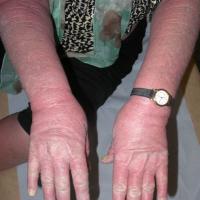 
	Same patient as previous image