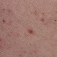 
	Close-up of the previous image