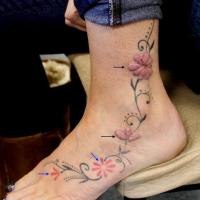 
	Allergic reaction to red tattoo dye

	The upper…