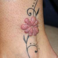 
	Same patient as previous image