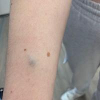 Same patient as previous image
Copied with kind…