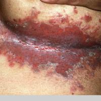 Same patient as previous image