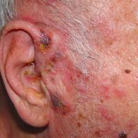 
	Same patient as previous image