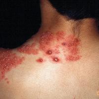 
	Same patient as previous image
