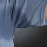 
	Primary hyperhidrosis of the axillae