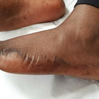 Same patient as previous image