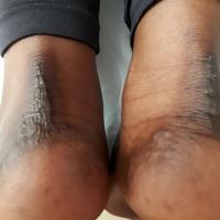 Same patient as previous image
