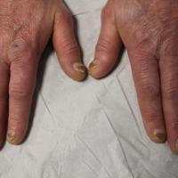 
	Same patient as previous image