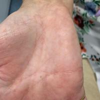Same patient as previous figure