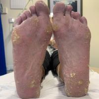 Same patient as previous figure