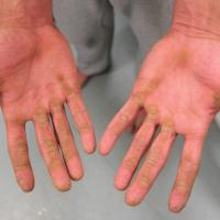 
	Same patient as previous image