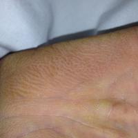 
	Same patient as previous image