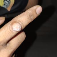 
	Knuckle pad

	Image copied with kind permission…
