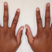 
	Knuckle pads

	Image copied with kind…