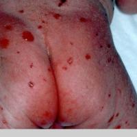 
	Same patient as previous image