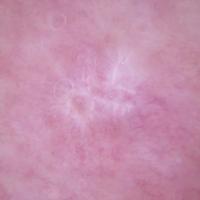 
	Same patient as previous image

	The…