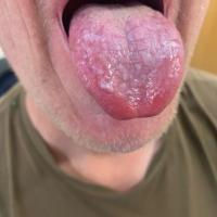 Same patient as previous figure
